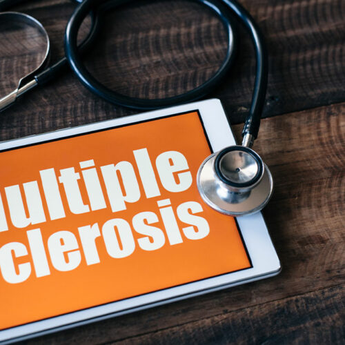 5 Early Warning Signs of Multiple Sclerosis