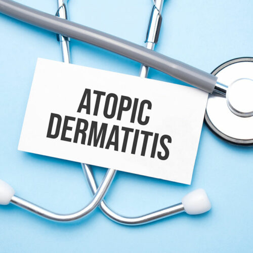 Atopic Dermatitis – Symptoms, Causes, and Remedies