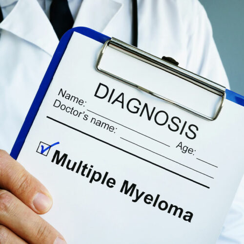 Multiple Myeloma – Signs and Nutritional Choices